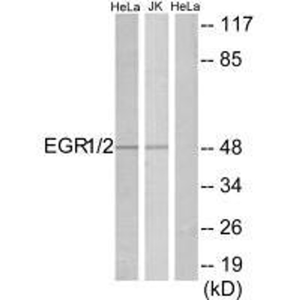 EGR1/EGR2 Antibody (PACO21743)