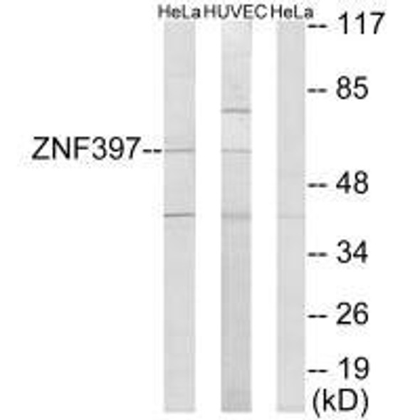 ZNF397 Antibody (PACO21899)