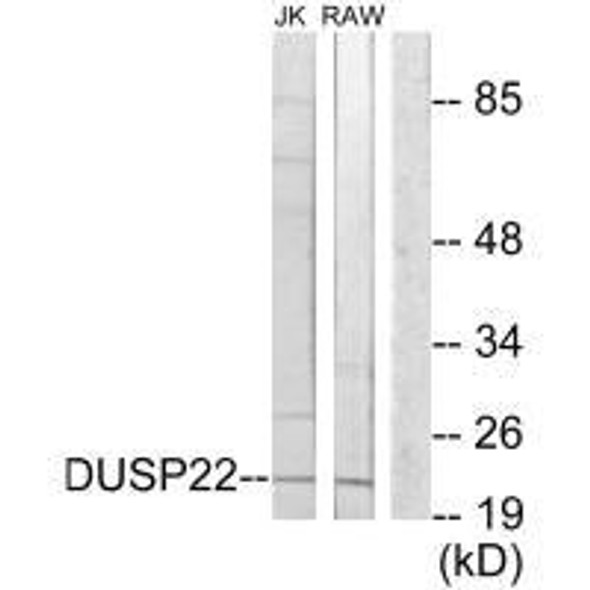 DUSP22 Antibody (PACO21962)