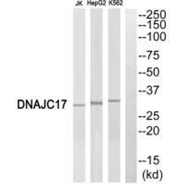 DNAJC17 Antibody (PACO21964)