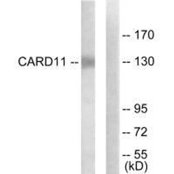 CARD11 Antibody (PACO22023)