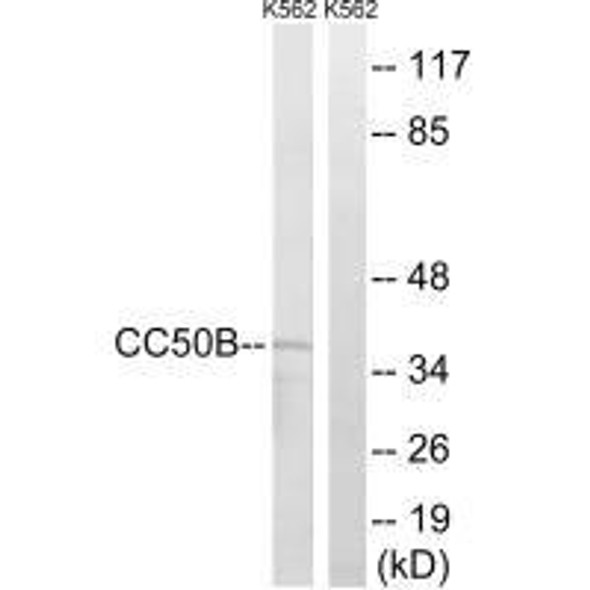 TMEM30B Antibody (PACO22024)