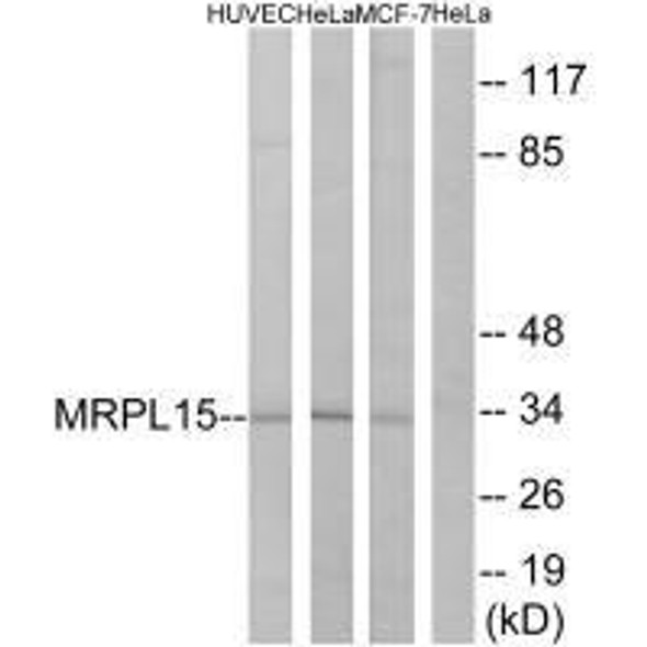 MRPL15 Antibody (PACO22087)