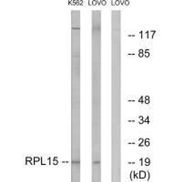 RPL15 Antibody (PACO22099)