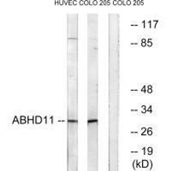 ABHD11 Antibody (PACO22109)
