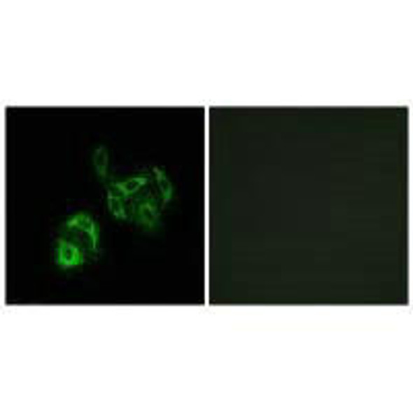 SLC27A4 Antibody (PACO22390)