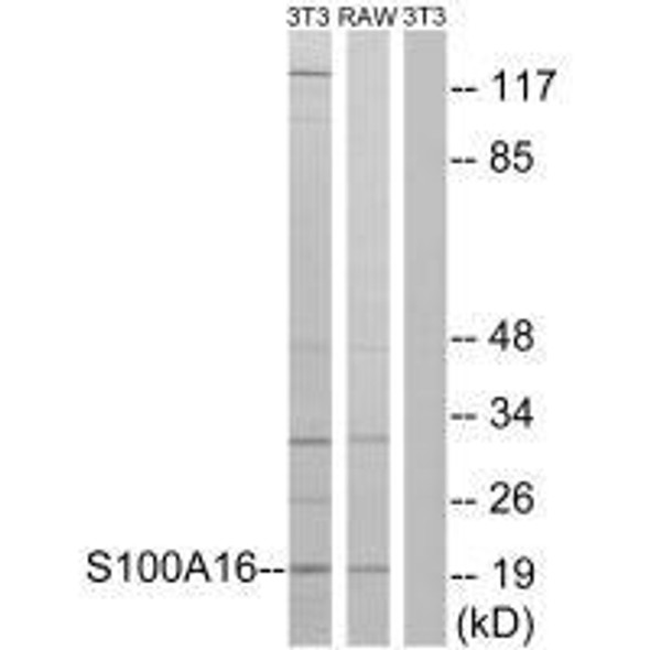 S100A16 Antibody (PACO22528)