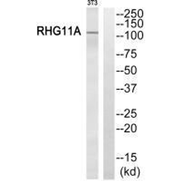 ARHGAP11A Antibody (PACO22567)