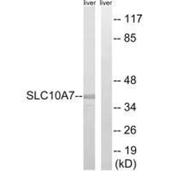 SLC10A7 Antibody (PACO22618)