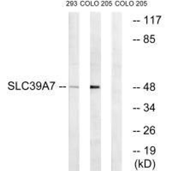 SLC39A7 Antibody (PACO22699)