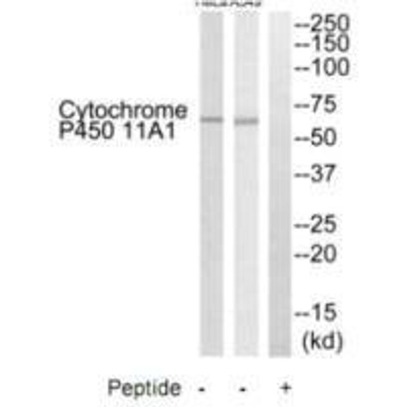 CYP11A1 Antibody (PACO22840)