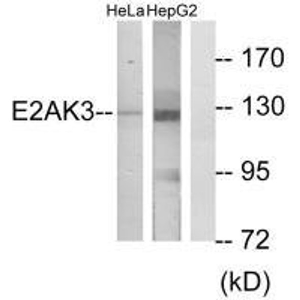 EIF2AK3 Antibody (PACO23288)
