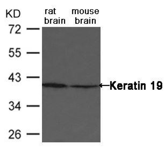 KRT19 Antibody (PACO23600)