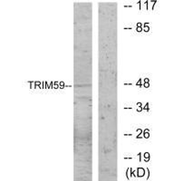 TRIM59 Antibody (PACO23755)