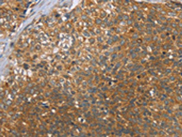 CCL21 Antibody (PACO14208)