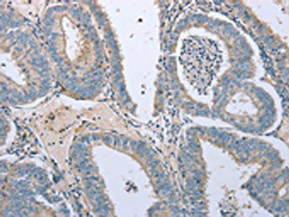 TNFRSF25 Antibody (PACO14355)
