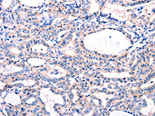 DUSP12 Antibody (PACO14396)