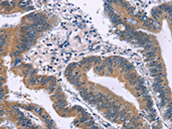 IRAK1BP1 Antibody (PACO14603)