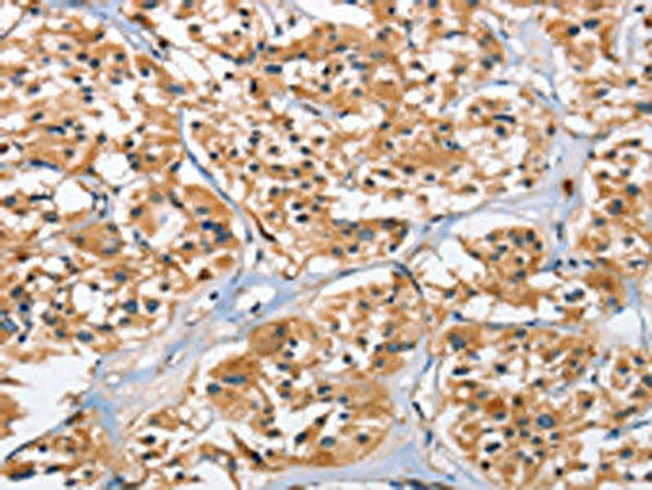 EIF4EBP2 Antibody (PACO15885)