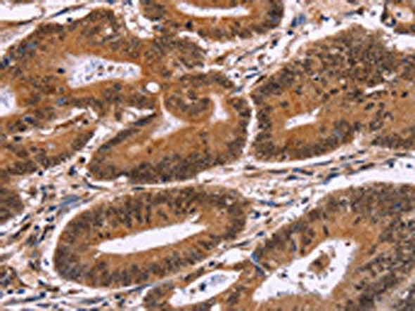 CARD11 Antibody (PACO15927)