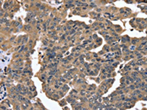 FGFR1OP2 Antibody (PACO16343)