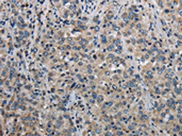 MCM3AP Antibody (PACO16394)