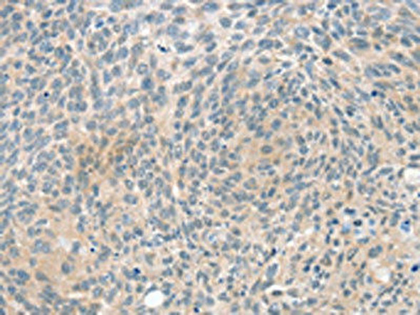 PPP2CA Antibody (PACO16885)