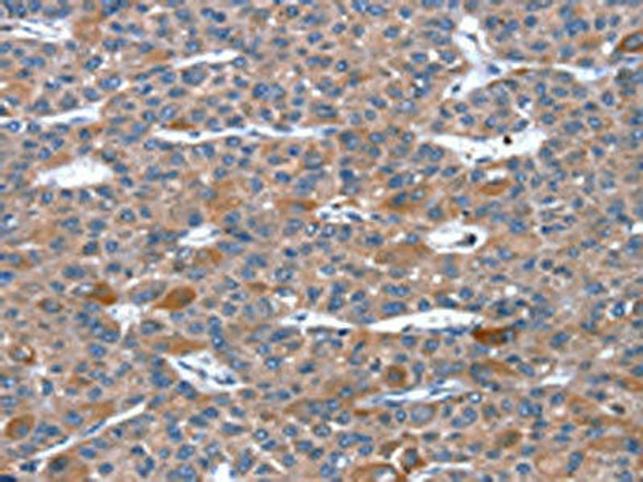 RGS11 Antibody (PACO16976)