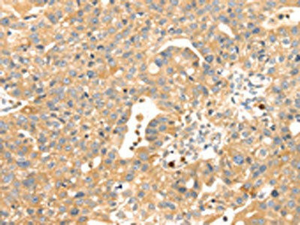 S100A12 Antibody (PACO17033)