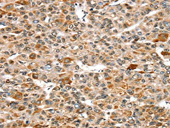 SNX15 Antibody (PACO17129)