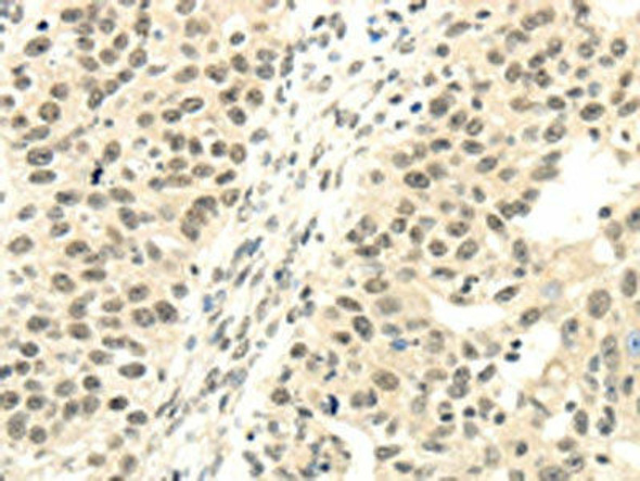 TBL1XR1 Antibody (PACO17215)
