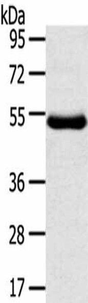 TMPRSS11D Antibody (PACO17284)