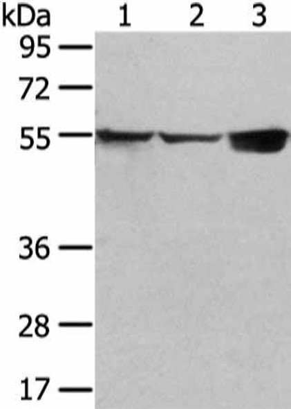 UGT1A10 Antibody (PACO17366)