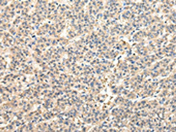 VPS45 Antibody (PACO17433)