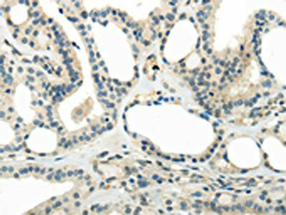 CYP19A1 Antibody (PACO17604)