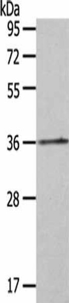 HOXA11 Antibody (PACO18076)