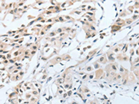 CHRNA10 Antibody (PACO18264)