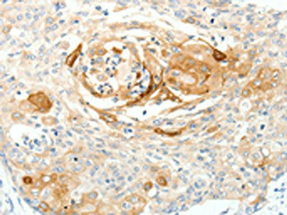 SCN10A Antibody (PACO18877)