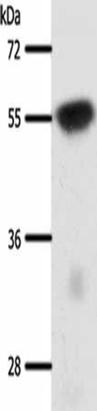 SLC32A1 Antibody (PACO18903)