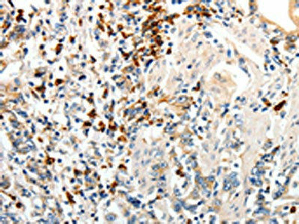 CD93 Antibody (PACO18979)