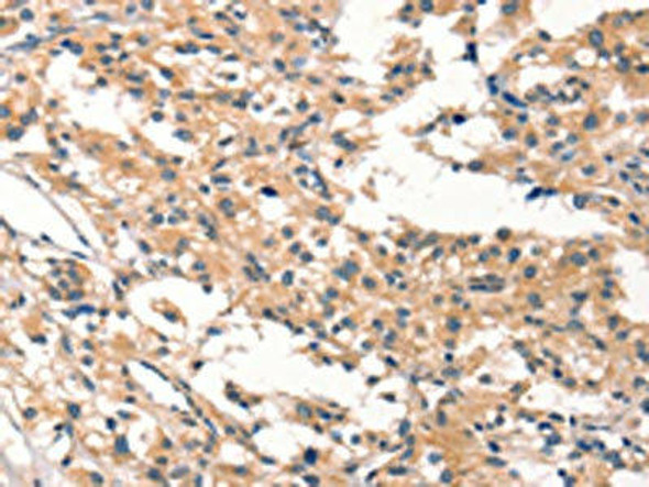 CYP46A1 Antibody (PACO19531)