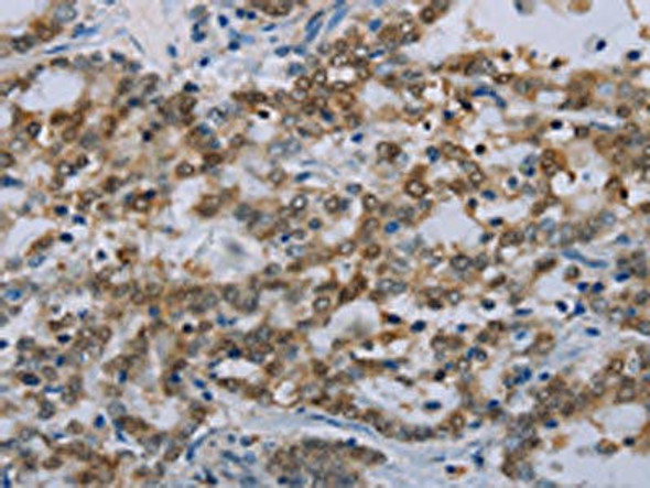 MED12 Antibody (PACO20149)