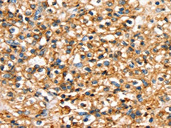 SLC34A3 Antibody (PACO20503)