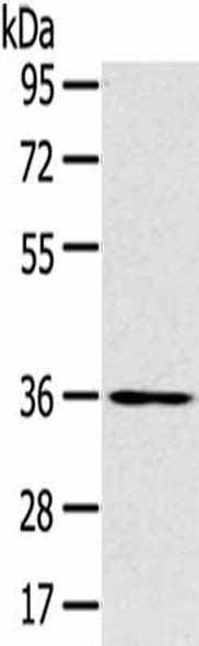 SLC39A9 Antibody (PACO20507)