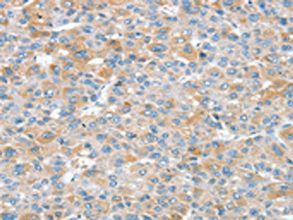 SNX25 Antibody (PACO20571)