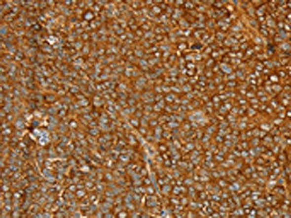 STK32A Antibody (PACO20617)