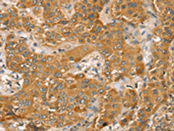 TRIM45 Antibody (PACO20700)