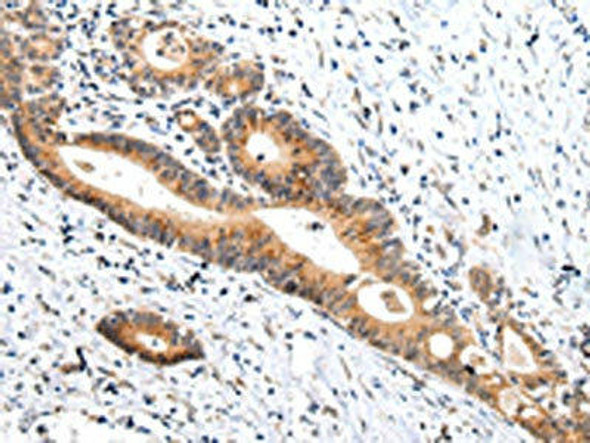 ZNF281 Antibody (PACO20949)
