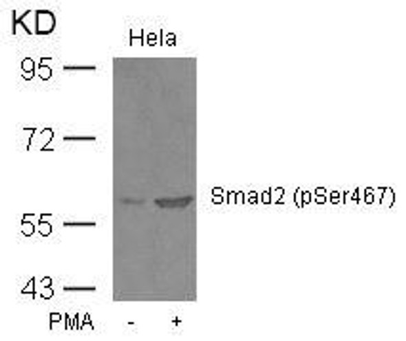 Phospho-SMAD2 (Ser467) Antibody (PACO23888)