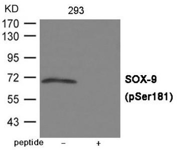 Phospho-SOX9 (Ser181) Antibody (PACO23945)